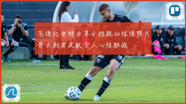 范德比尔特分享小指脱臼惊悚照片骨头刺穿皮肤令人心惊胆战